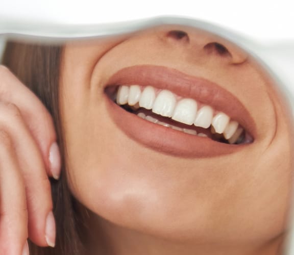 Womans smile with teeth showing in a hand held mirror